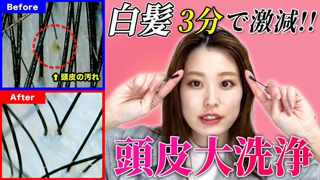 【白髪改善】お風呂の前の3分で白髪がみるみる激減！抜け毛や頭皮の嫌な臭いにも効果的な頭皮ケア♡