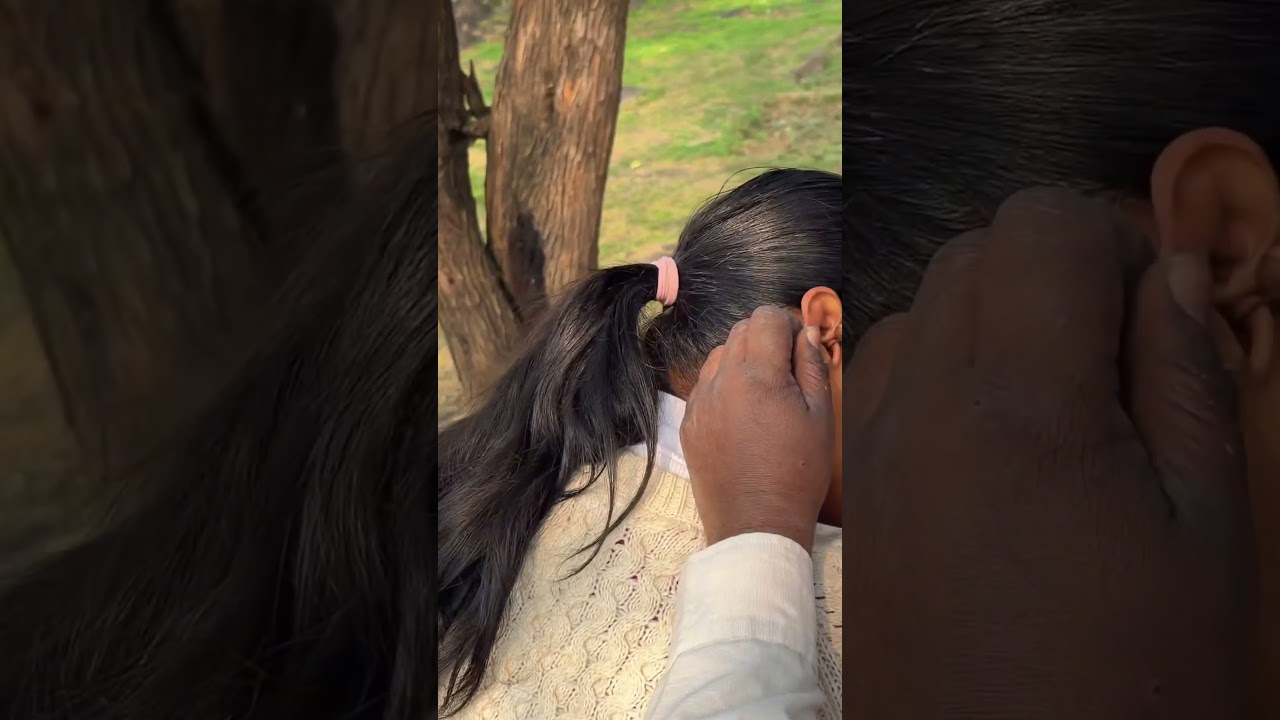 HARD EARWAX REMOVAL 