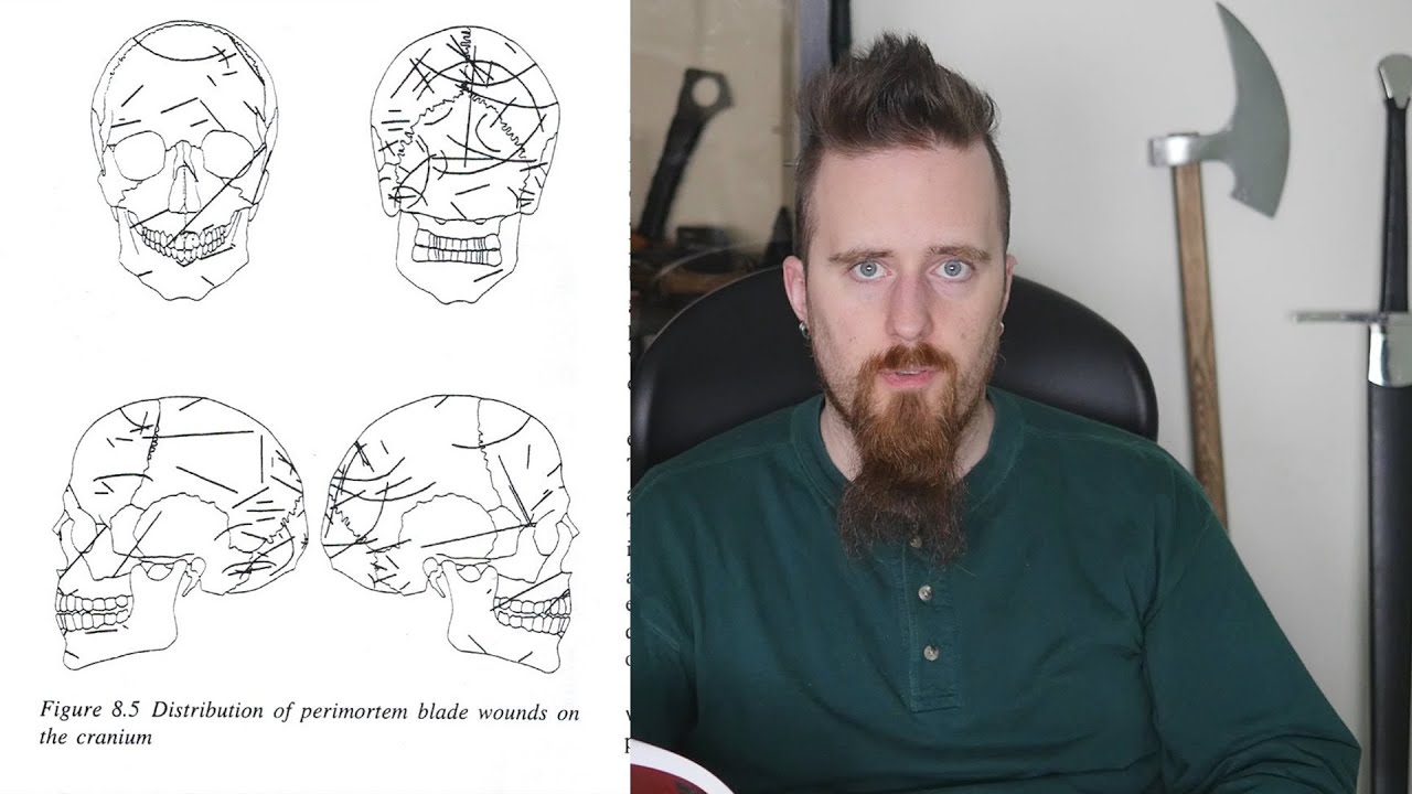 Go for the head - injuries from the medieval battle of Towton (1461)