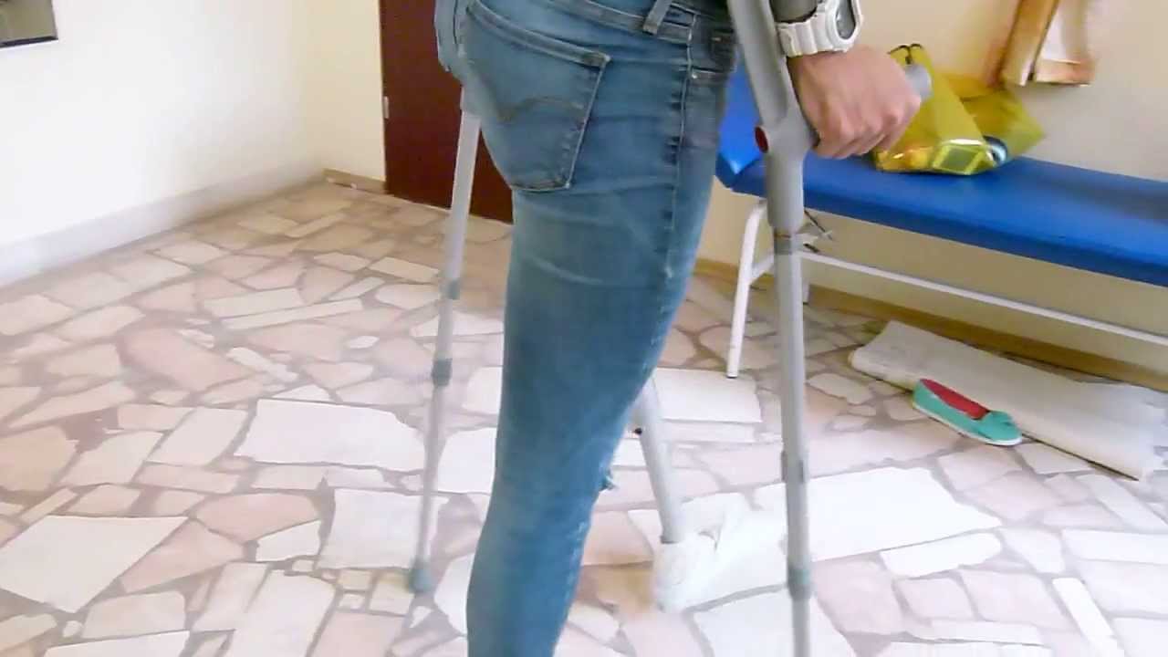 Przymiarka protezy nogi -proteza uda, pierwsze kroki bez barierek. Ortotyka Protezy Kończyn Dolnych