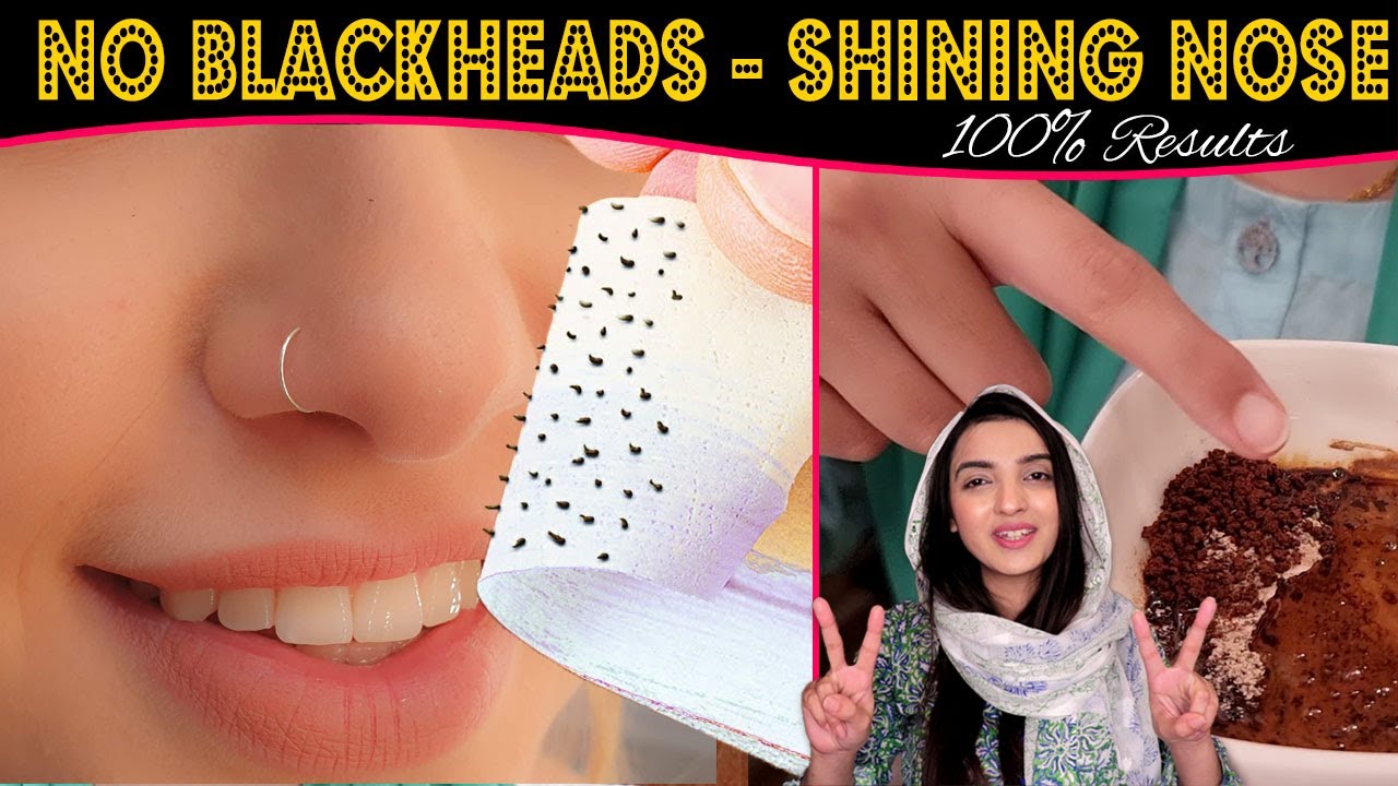 Remove BLACKHEADS & Get Super Shiny Nose Beautiful Soft Skin