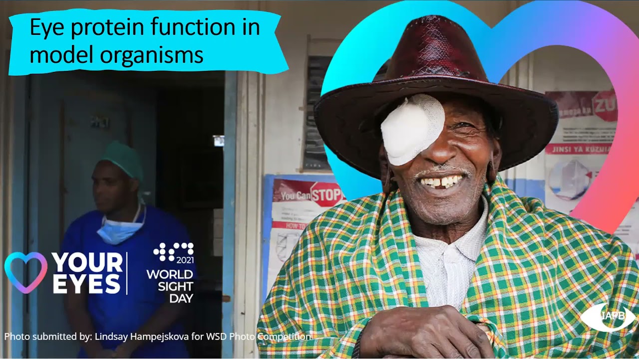 Sight, vision and UniProt proteins