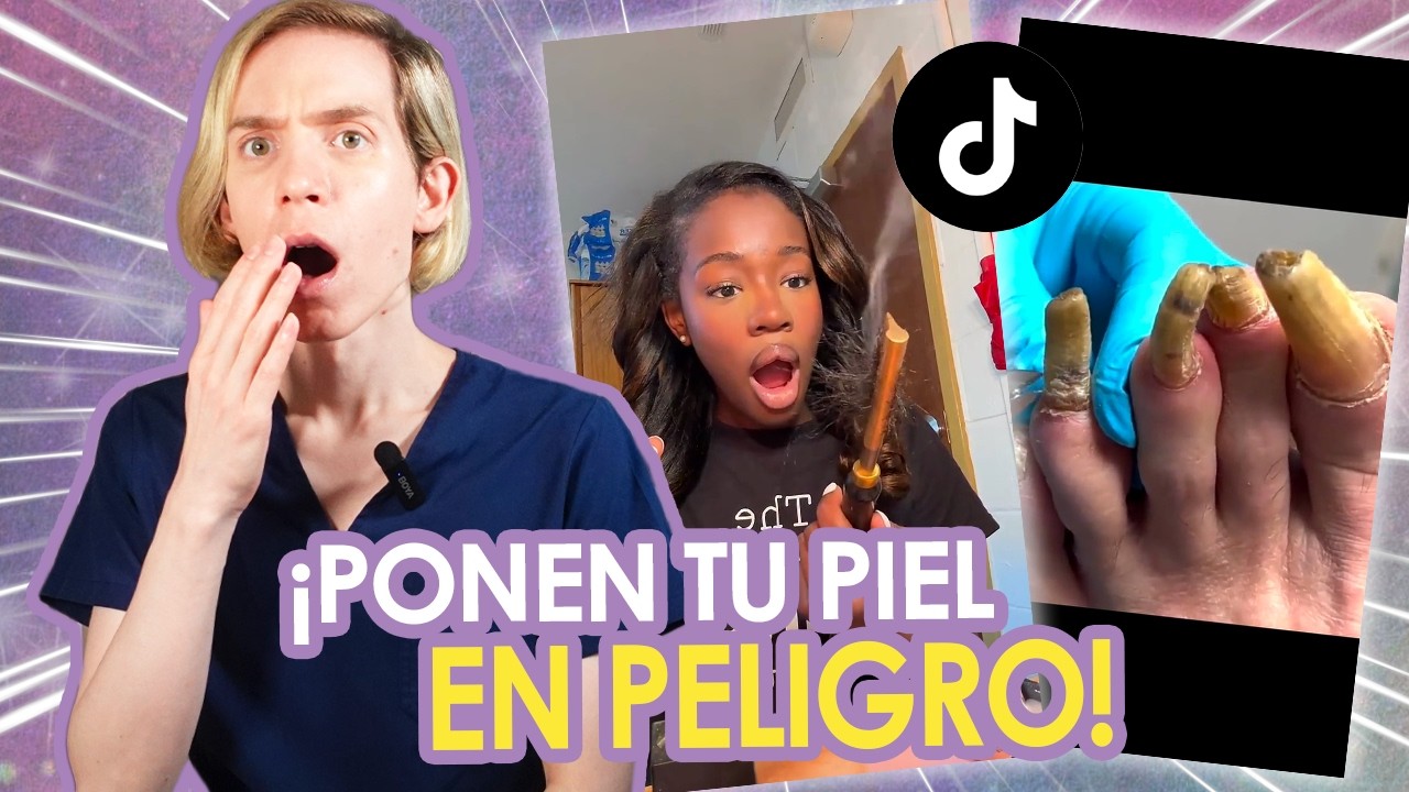 DERMATOLOGO reacciona a TIK TOK 21 - Quemaduras, carne cruda y más - Simon Scarano Dermatologo