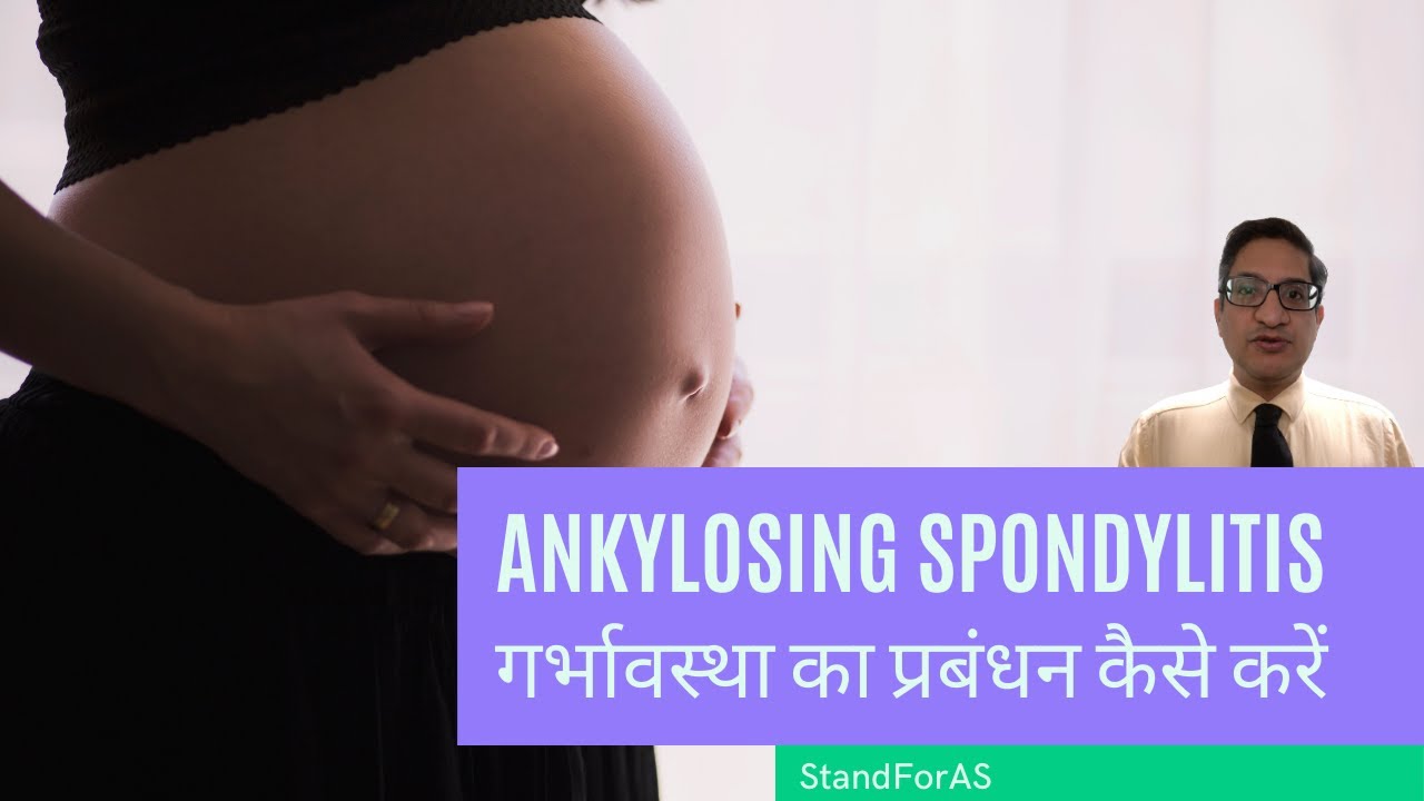Ankylosing spondylitis: गर्भावस्था का प्रबंधन कैसे करें