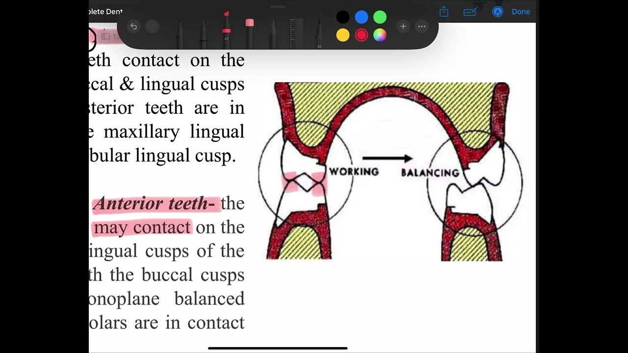 Occlusion in complete denture