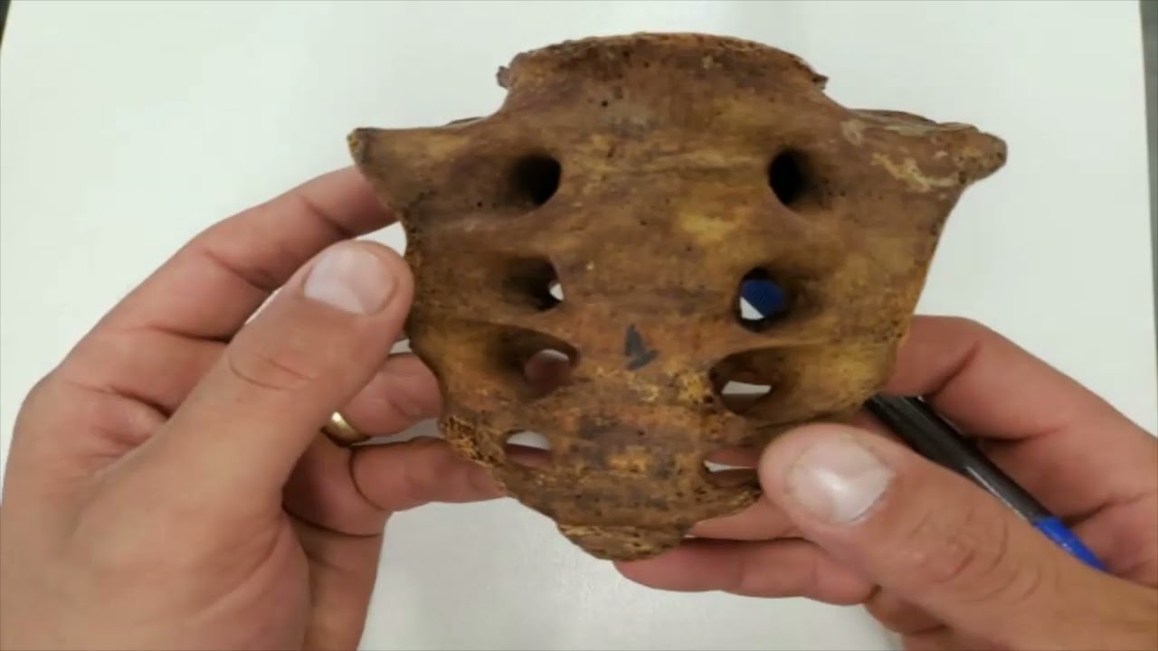 VÍDEO AULA PRÁTICA DA COLUNA VERTEBRAL PARTE 3 - OSSO SACRO