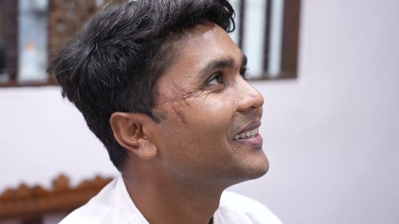 Big Scar on Patients Face easily Removable - Consultation - Dr. Sunil Richardson