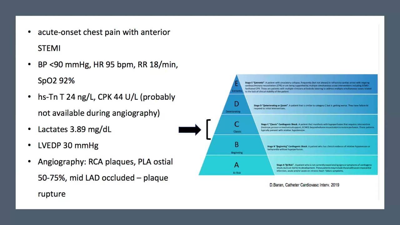 Cardiogenic shock - Dr. Mina samy