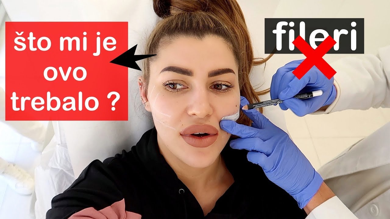 Uklanjam filere!