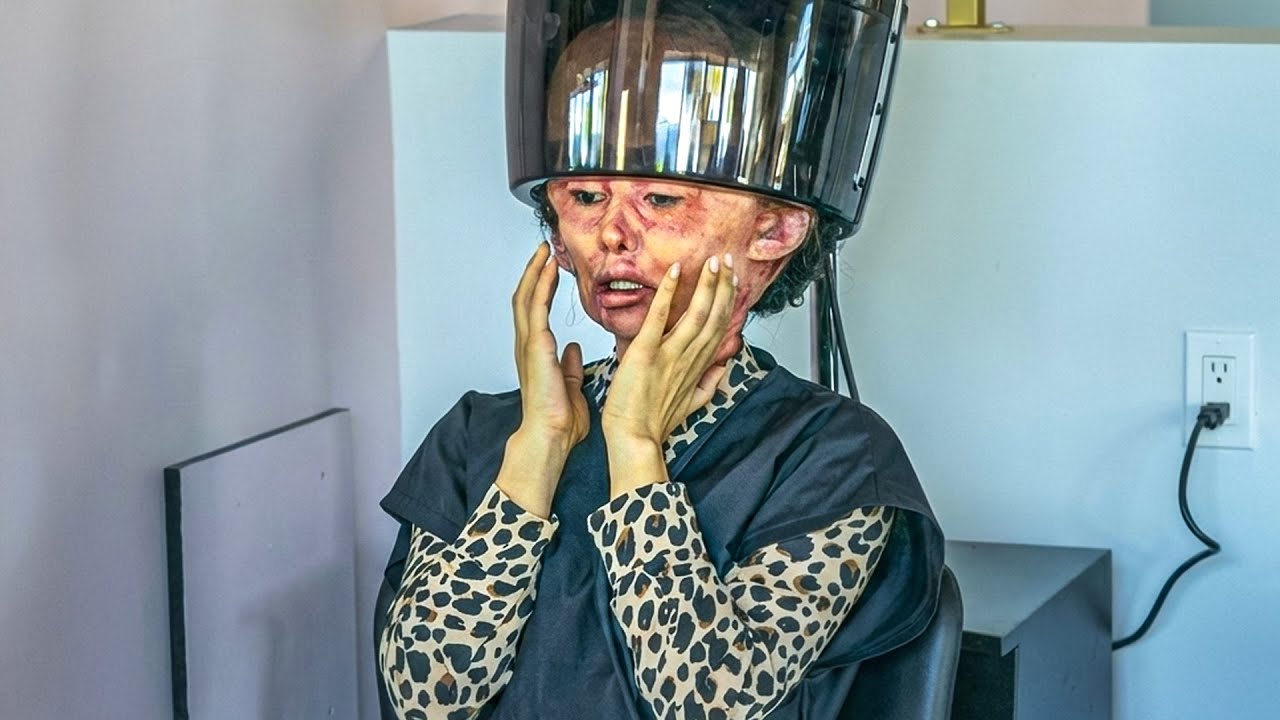 بتتصدم لما بتفوق من عملية تجميل وبتلاقي جـلـد وشهـا واقع علي الارض