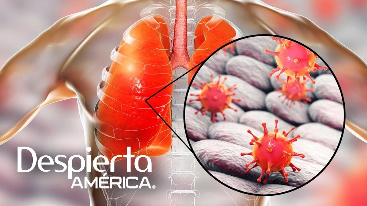 Adenovirus: causas, síntomas, tratamiento y prevención | Dr. Juan