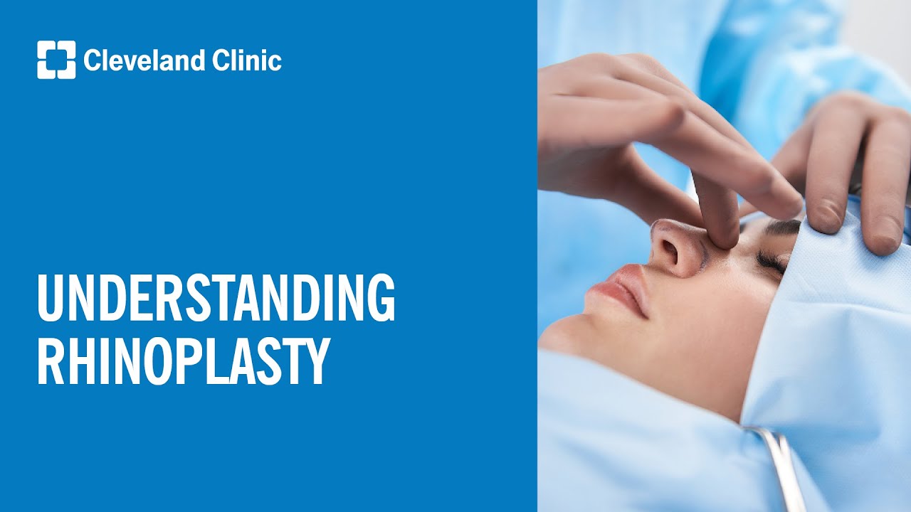 What is Rhinoplasty?