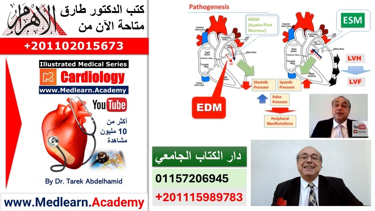 Aortic Regurgitation (Incompetence)   #internal_medicine #cme   #محاضرات_باطنة #medical