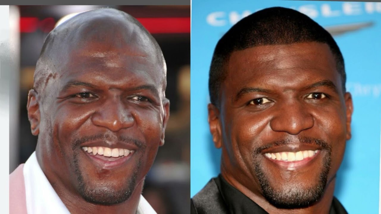 Famosos calvos ( famous bald people )