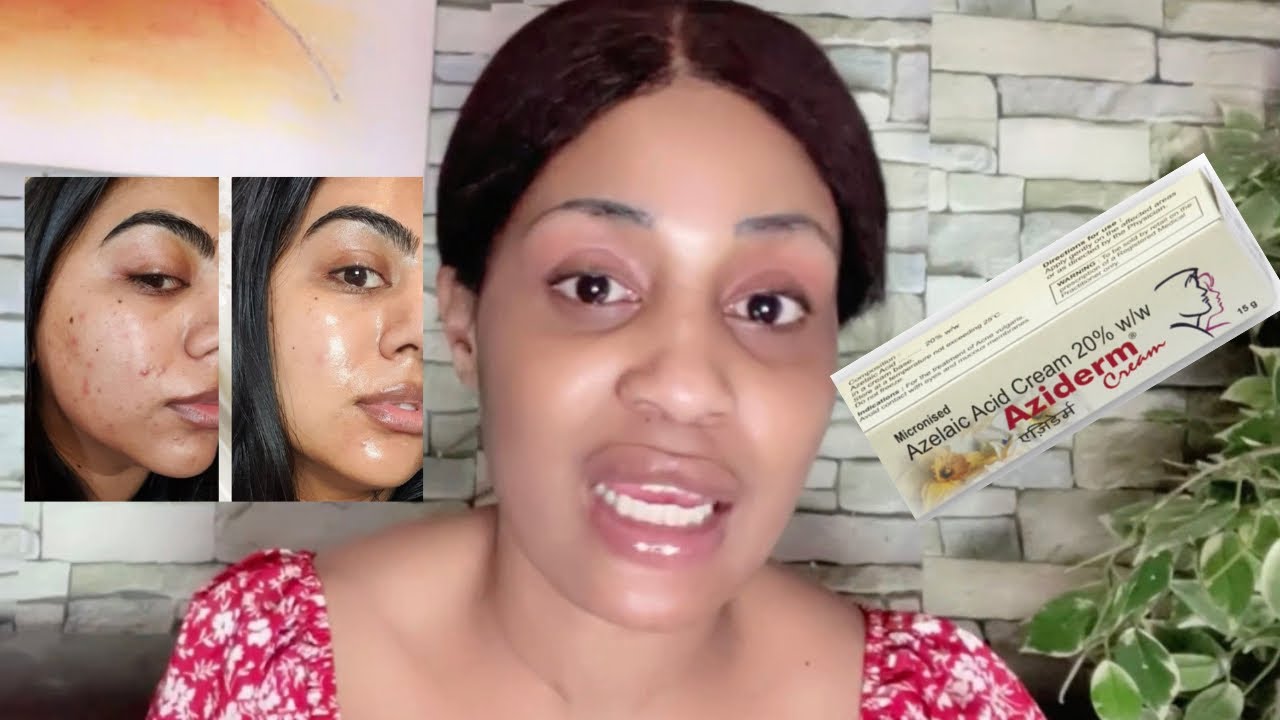 Résultats de l’acide azélaïque pour les tâches de bouton et l’hyperpigmentation | glow pour la peau