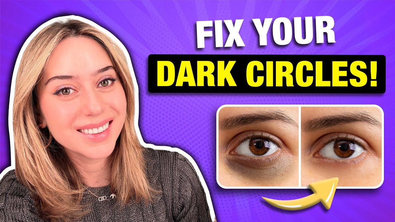 Dark Circles: REAL Solutions That Work! | Dr. Shereene Idriss