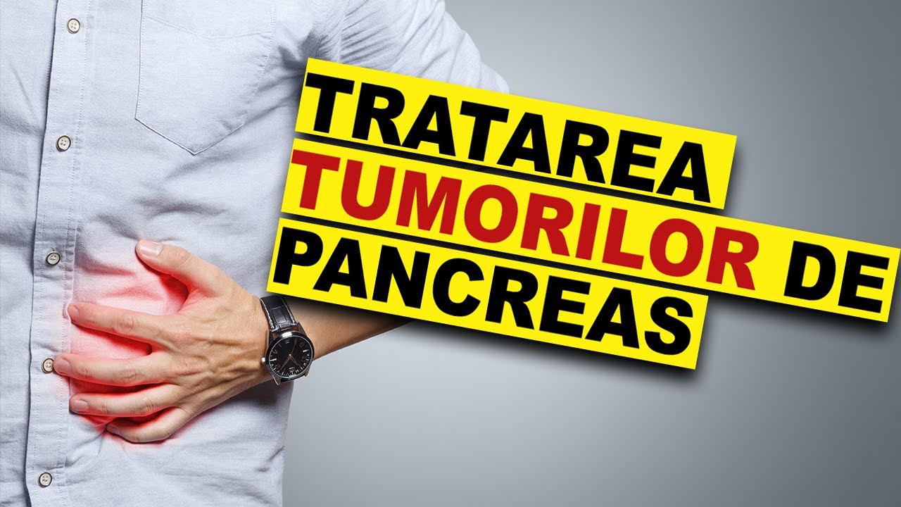 Radioterapia în tratarea cancerului de pancreas