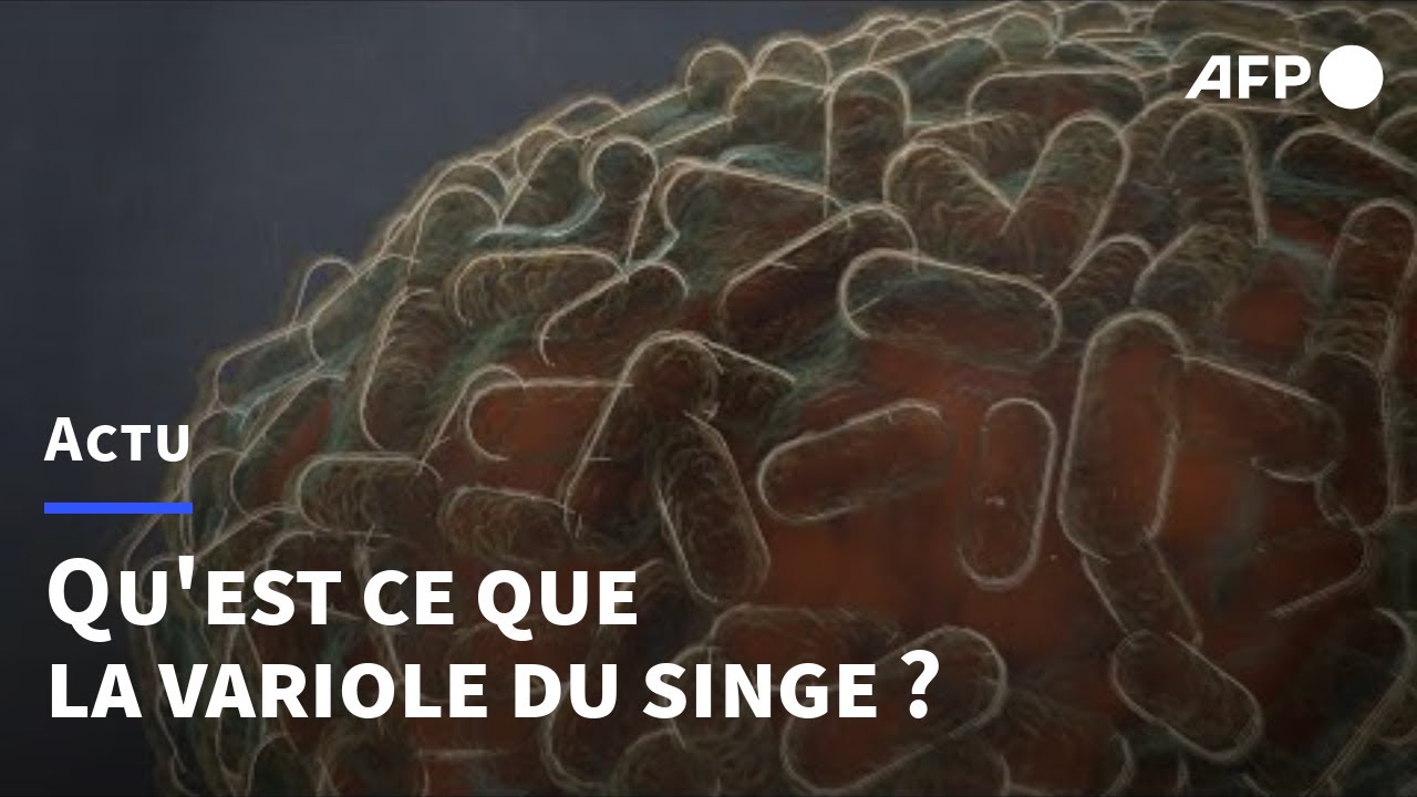 La variole du singe expliquée | AFP