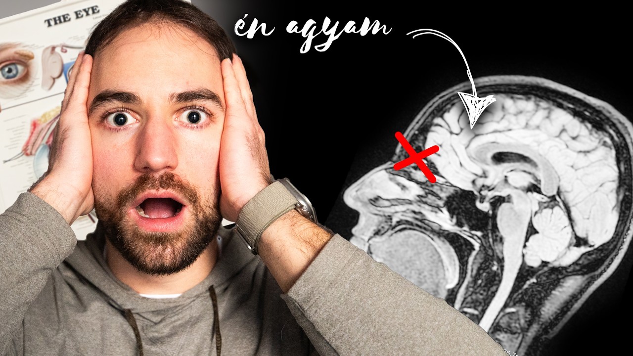 Egy H&oacute;napja NEM L&Aacute;TOK Rendesen! (&iacute;gy kivizsg&aacute;ltattam mi a baj)