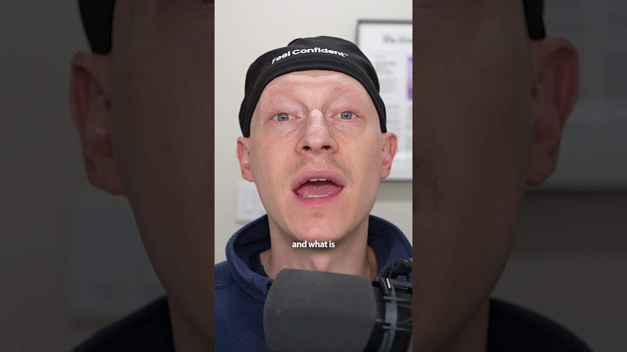 Corner Lip Lift vs Lip Filler