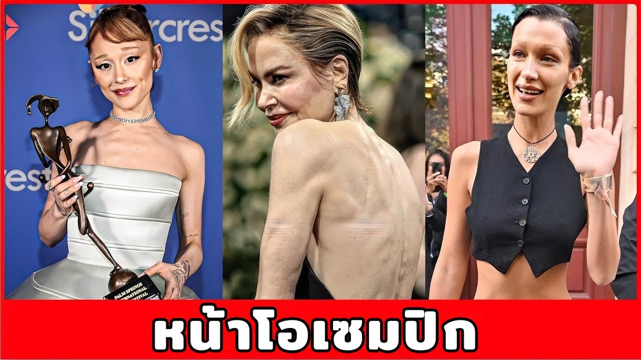 7 การเปลี่ยนแปลงสุดช็อกของคนดังกับ OZEMPIC ปี 2025 — ก่อนและหลังที่คุณคาดไม่ถึง