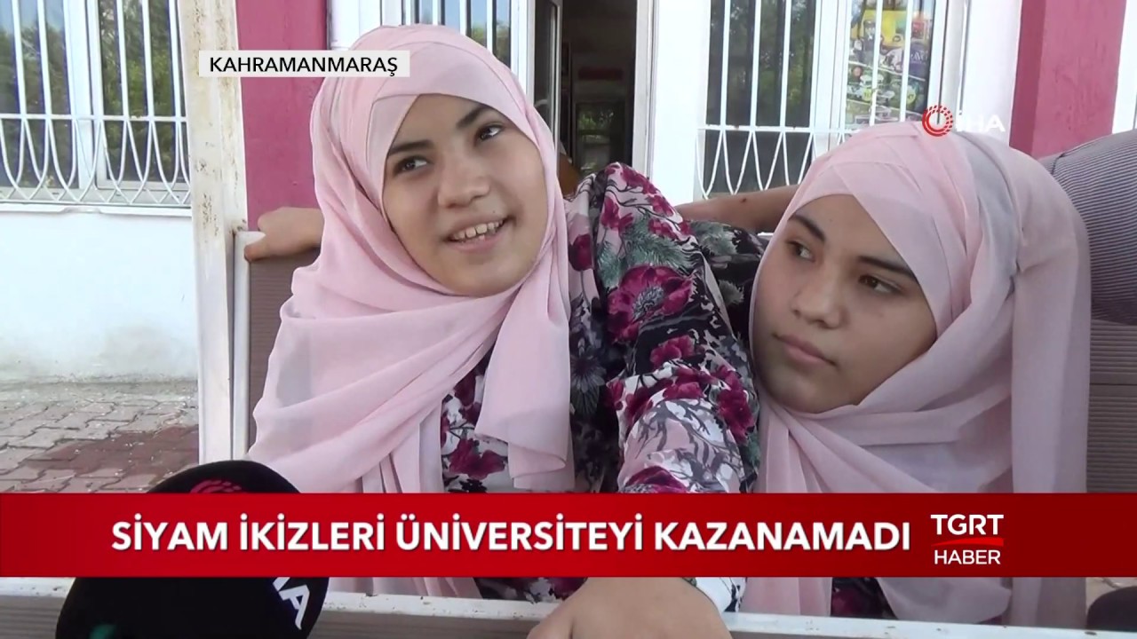 Siyam İkizleri Üniversiteyi Kazanamadı