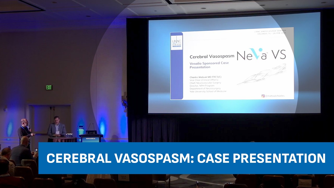 Cerebral vasospasm - Vesalio sponsored case presentation