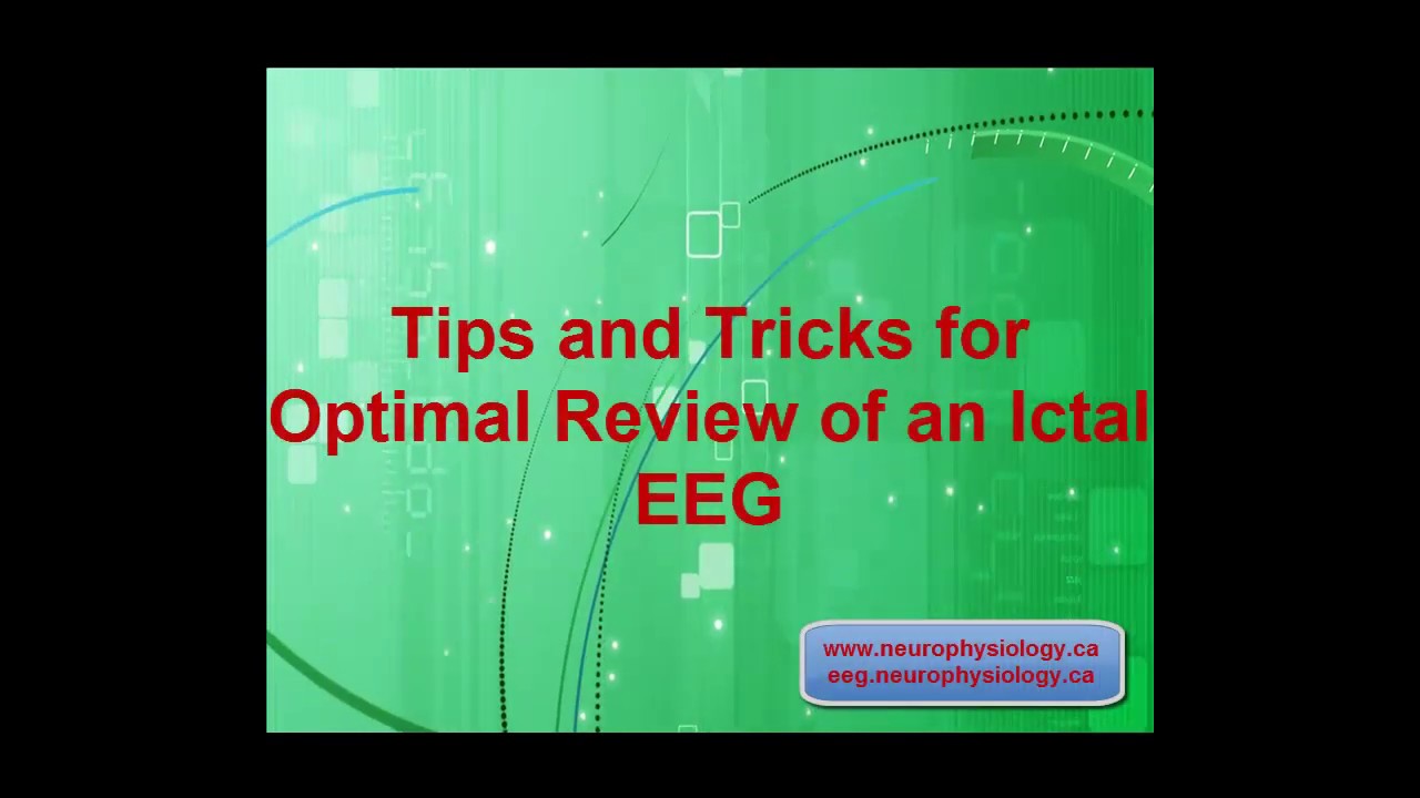 Tips and Tricks for Optimal Review of an Ictal EEG