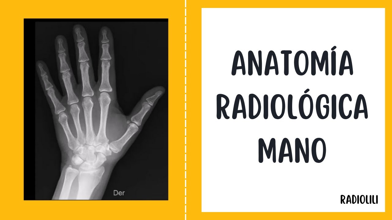 Anatomía Radiológica - Radiología Convencional: Mano - Proyección posteroanterior y lateral.