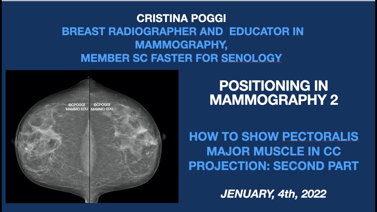 HOW TO SHOW PECTORALIS MAJOR MUSCLE IN CC PROJECTION: SECOND PART