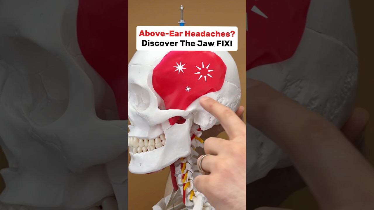 TMJ (Jaw Clenching) may be causing your headaches! #tmj #tmjtreatment #headache #headacherelief #tmd