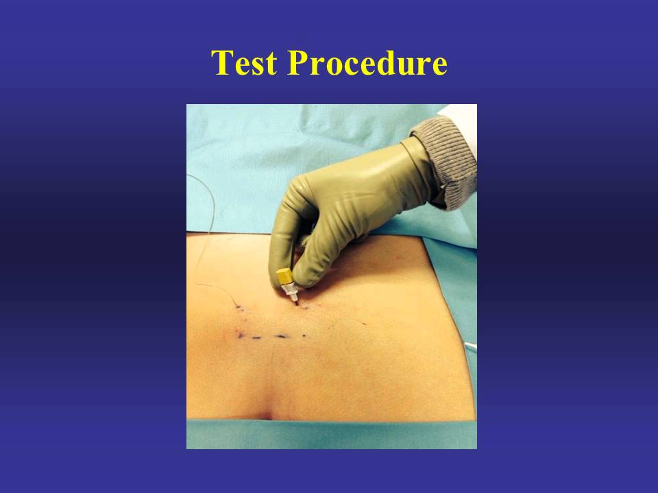 Percutaneous Nerve Testing in Office Step 1