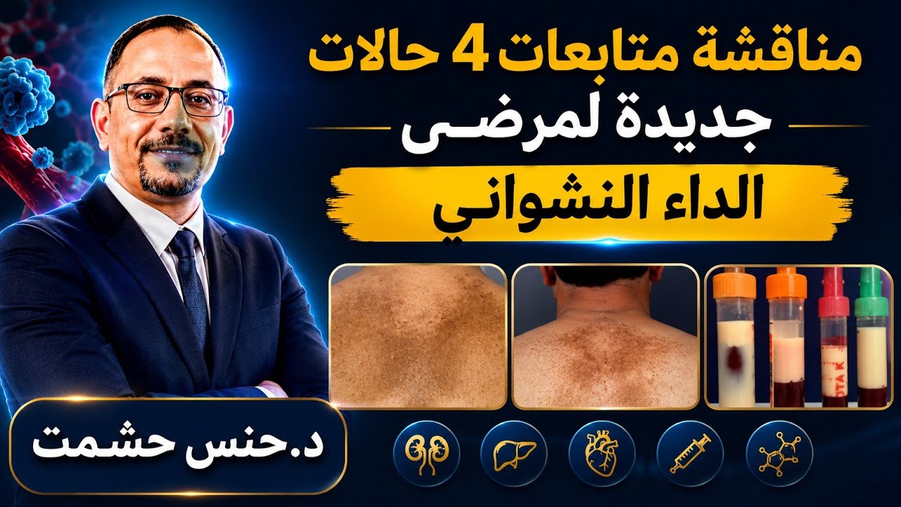 كيفية متابعة الداء النشواني/الدم الأبيض/متلازمةHLH/تحضير مشروبات في الكاتيل/أدويةالكوليسترول والمعدة
