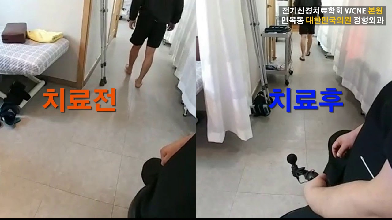인대파열 후 회복되는 학술적 원리를 아시나요? 알면 무섭지 않습니다.