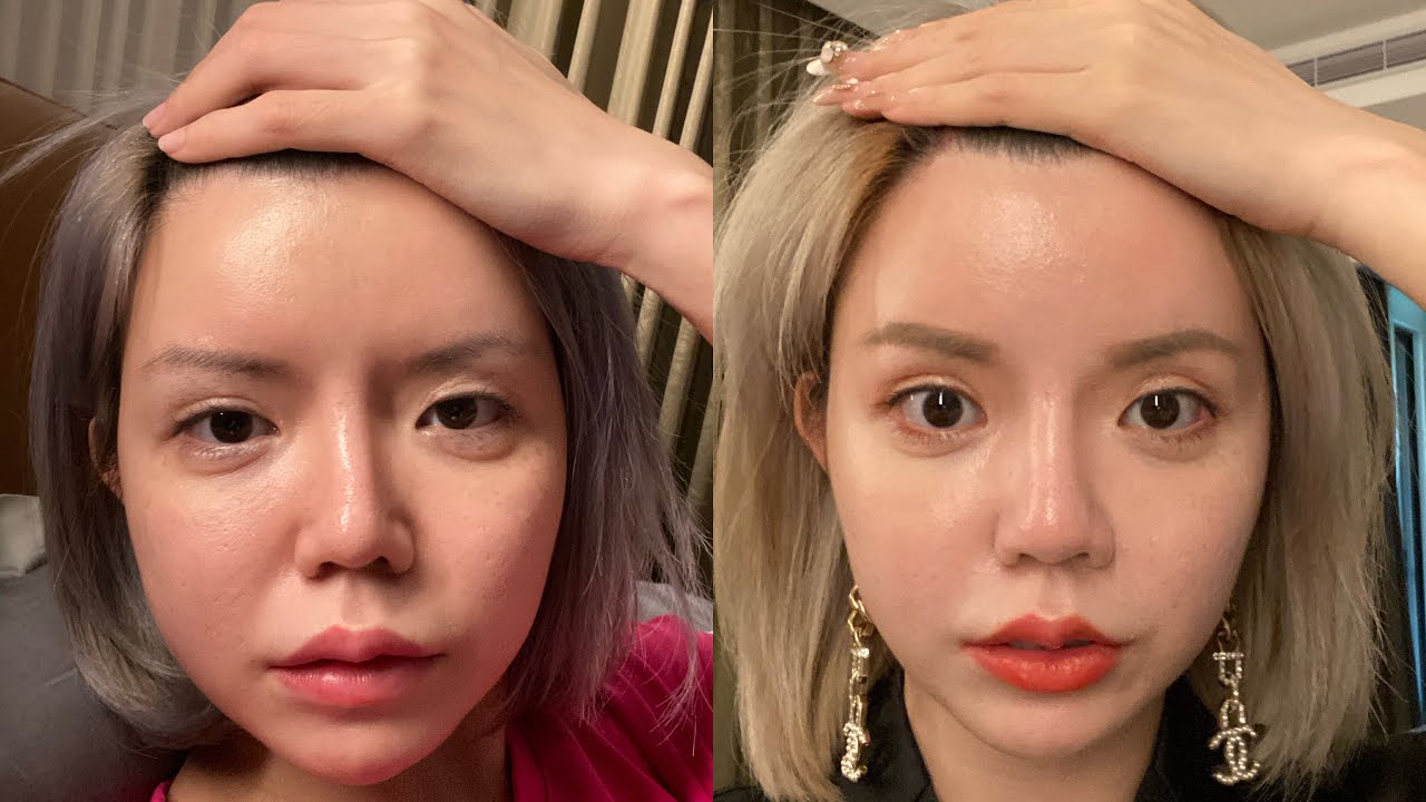 鼓起勇氣面對失敗（重修鼻頭＋隱形提眉＋法令紋墊片＋線彫拉提）