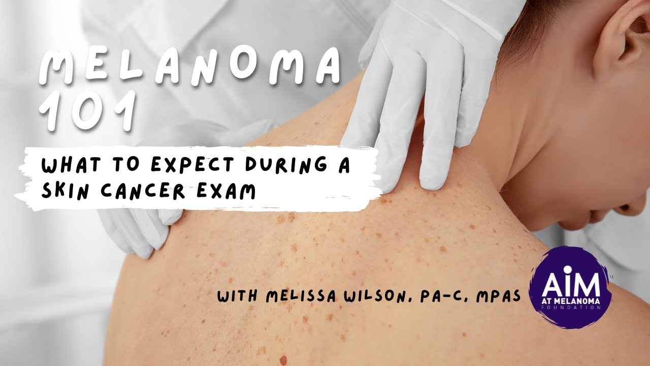 What to Expect During a Skin Exam