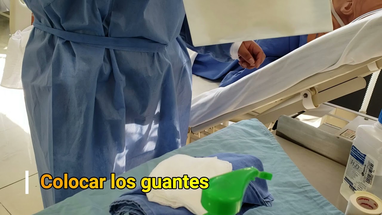Técnica para aspiración de secreciones con sistema abierto de aspiración.