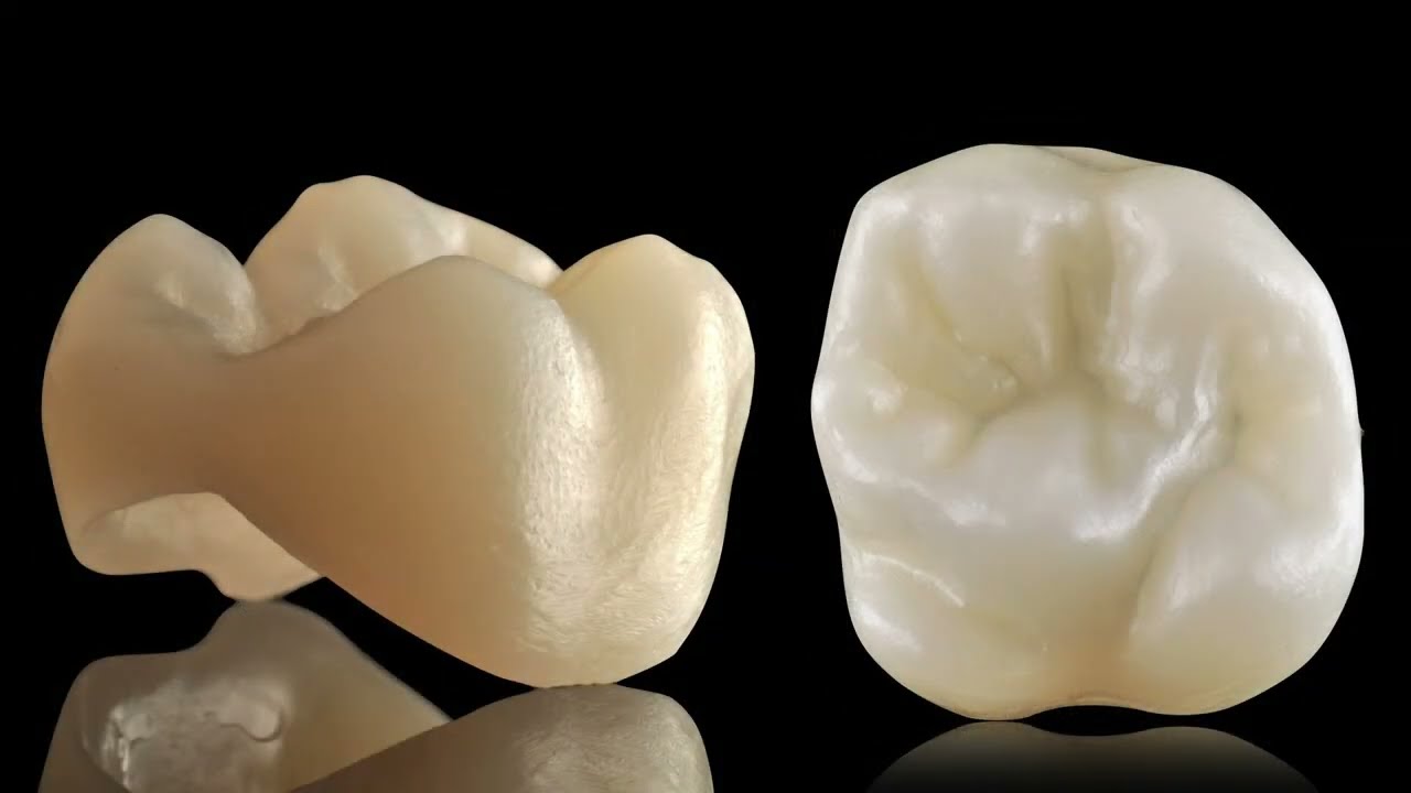 KATANA Zirconia - Fase di lavoro 3: tecnica di finitura estetica