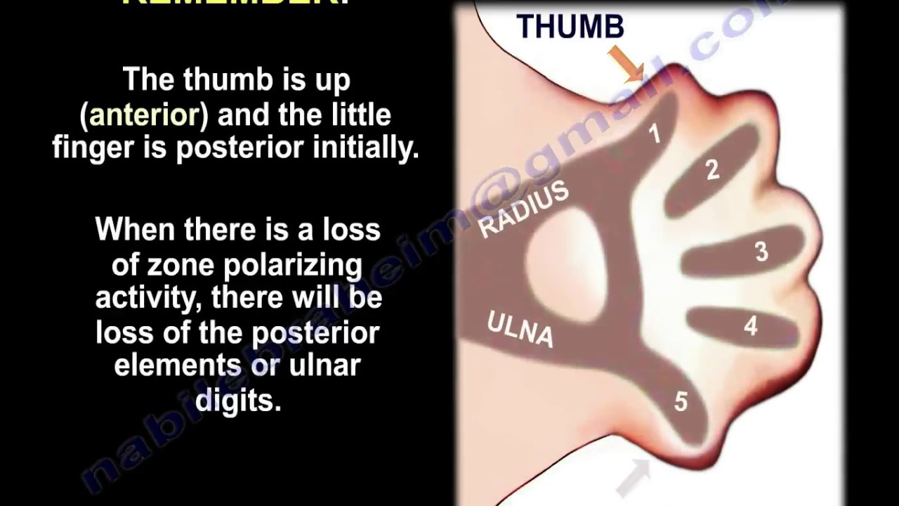 Apical Ectodermal Ridge, zone polarizing  Activity  Everything You Need To Know - Dr. Nabil Ebraheim