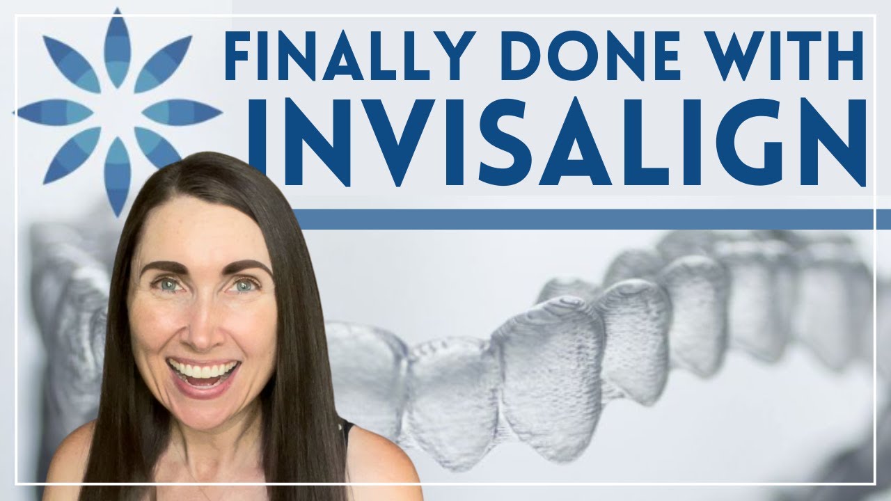 Стоит ли ждать Invisalign? Мой честный отзыв после завершения лечения | Плюсы и минусы
