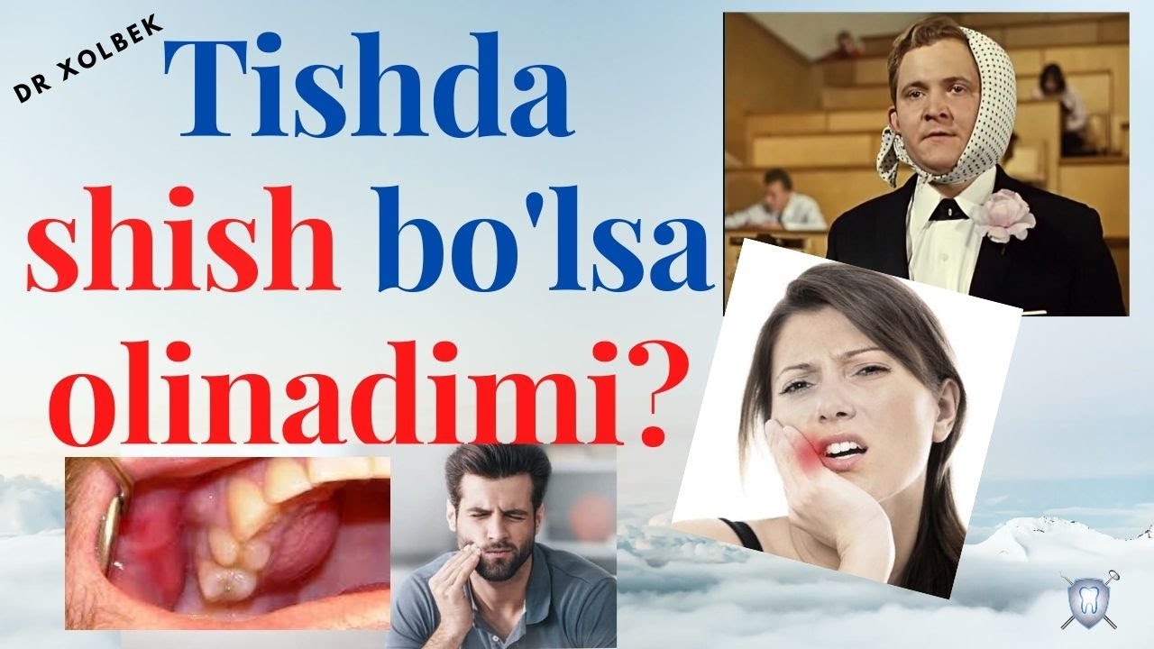Tish kasalliklaridan periodontit haqida qisqacha malumot. Тиш касалликларидан кискача маълумот.