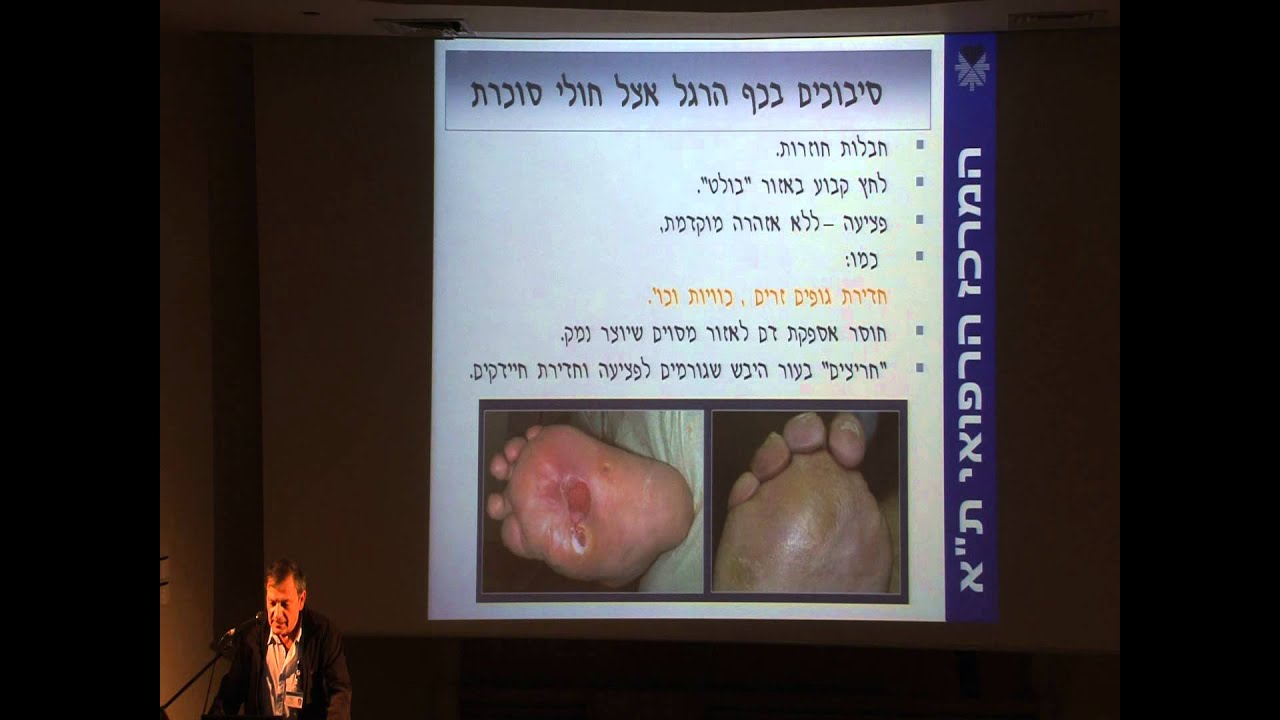 עקב אכילס - כף רגל סוכרתית