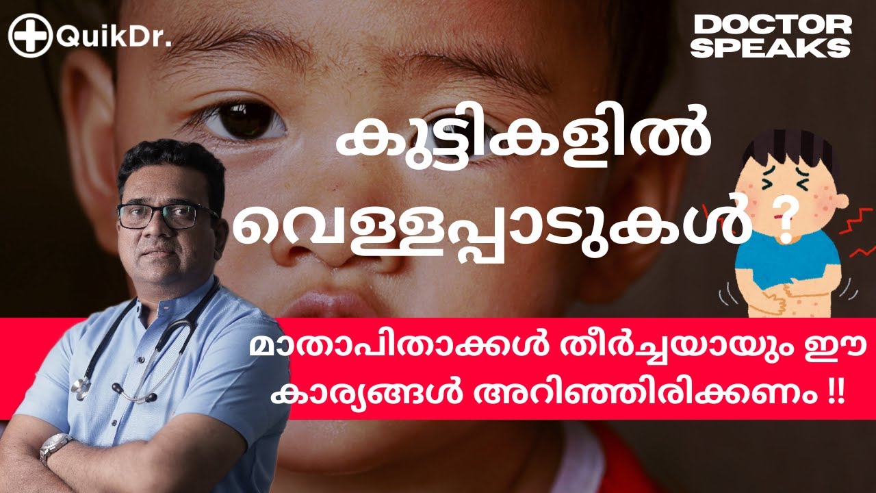 കുട്ടികളുടെ മുഖത്ത് വരുന്ന വെള്ളപ്പാടിന്റെ കാരണങ്ങളും പരിഹാരവും |White Patches on Baby 's Face