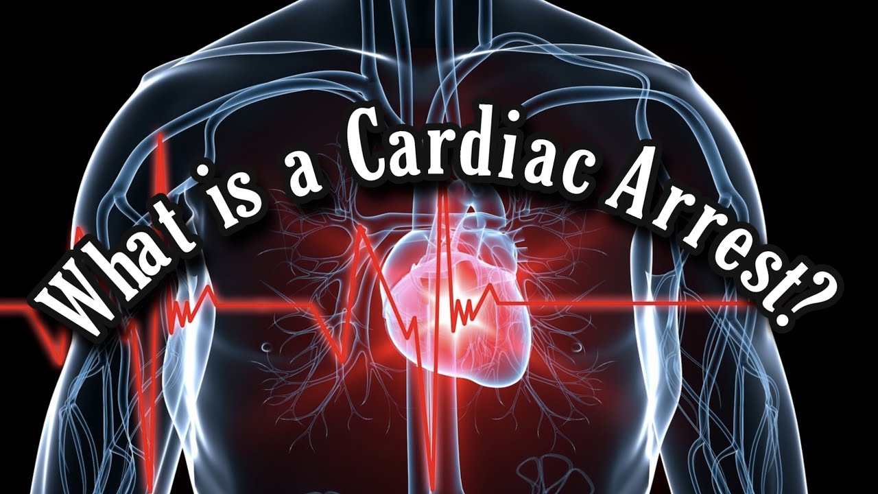 How Do Doctors Treat a CARDIAC ARREST In Hospital?!