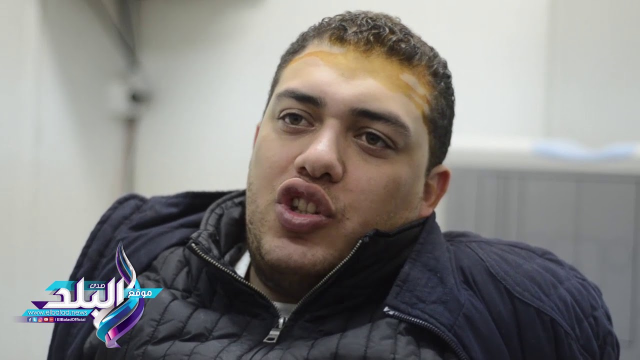 صدى البلد | احد مصابى حادث سيارة هشام جنينه : اهالى المستشار ضربونا