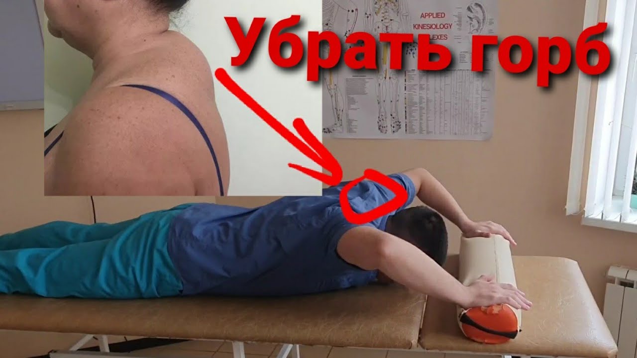 Упражнения для шеи. Как убрать холку на шее, 