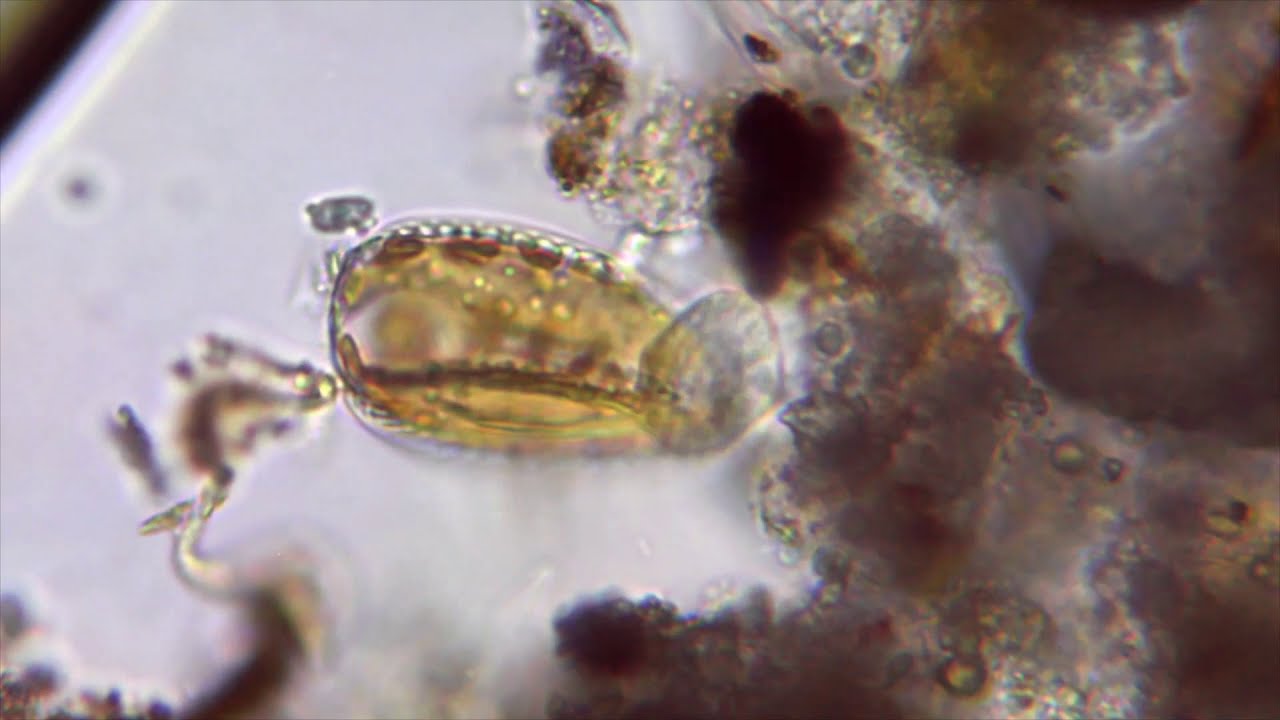 Plankton in water sample