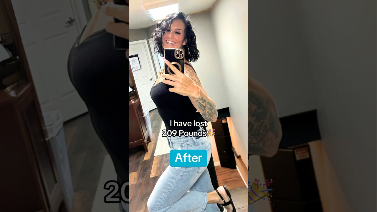I LOST 200 LBS! Gastric Sleeve 🎉