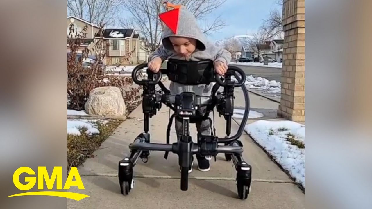 Toddler with Cerebral Palsy smiles as he takes his first steps