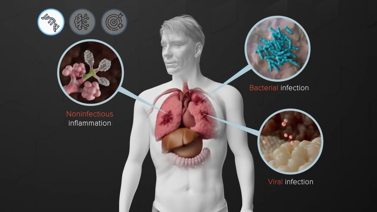 TriVerity: A New Approach to Diagnosing Acute Infection in the Emergency Department